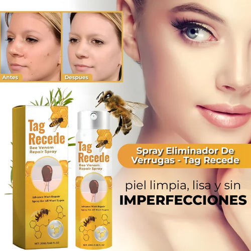 PROMO PAGA 1 LLEVA 2 - SPRAY ELIMINADOR DE VERRUGAS - TAG RECEDE 🐝